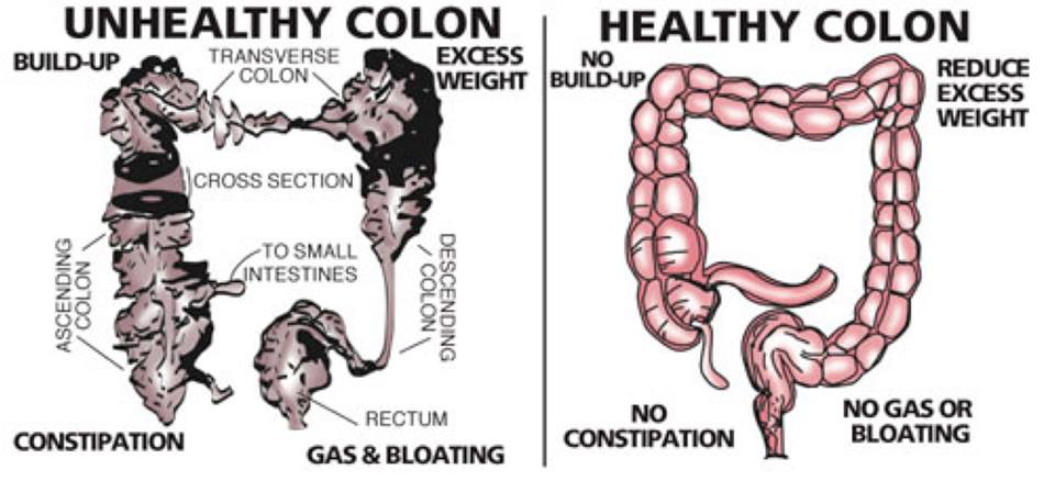 Colon Cleanse Or Liver Cleanse First